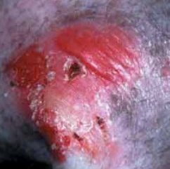 picture of canine skin problem picture of canine skin problem