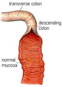 dog large intestine