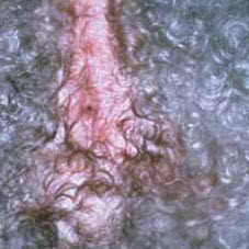 photos of dog skin rashes