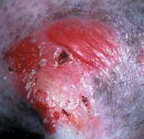 dog skin conditions and diseases