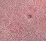pictures of dog skin disorders pictures of dog skin disorders