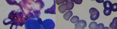 dog skin tumor cell comparison - side by side - magnified view