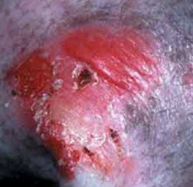 dog skin conditions and diseases